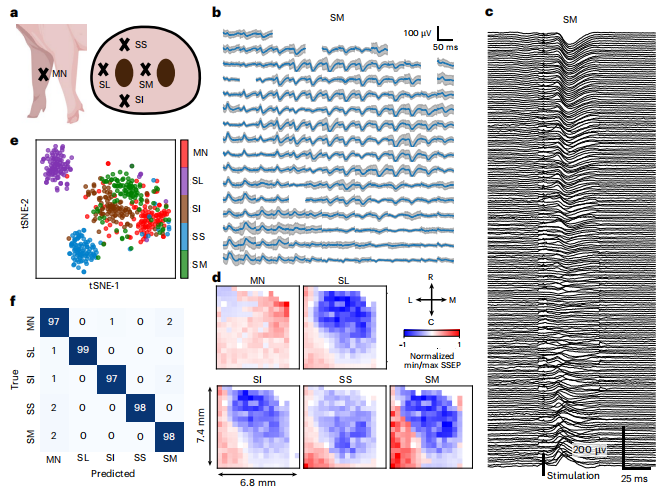 图丨猪模型体感皮层的 BISC 记录(来源:Nature Electronics)